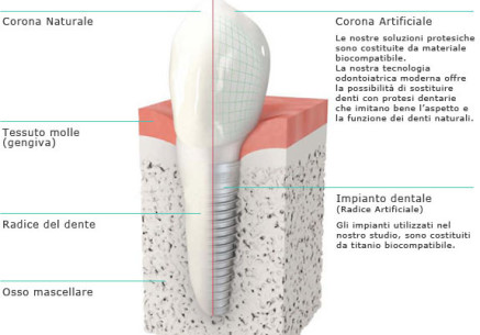 CLINIC TORINO - IMPIANTOLOGIA